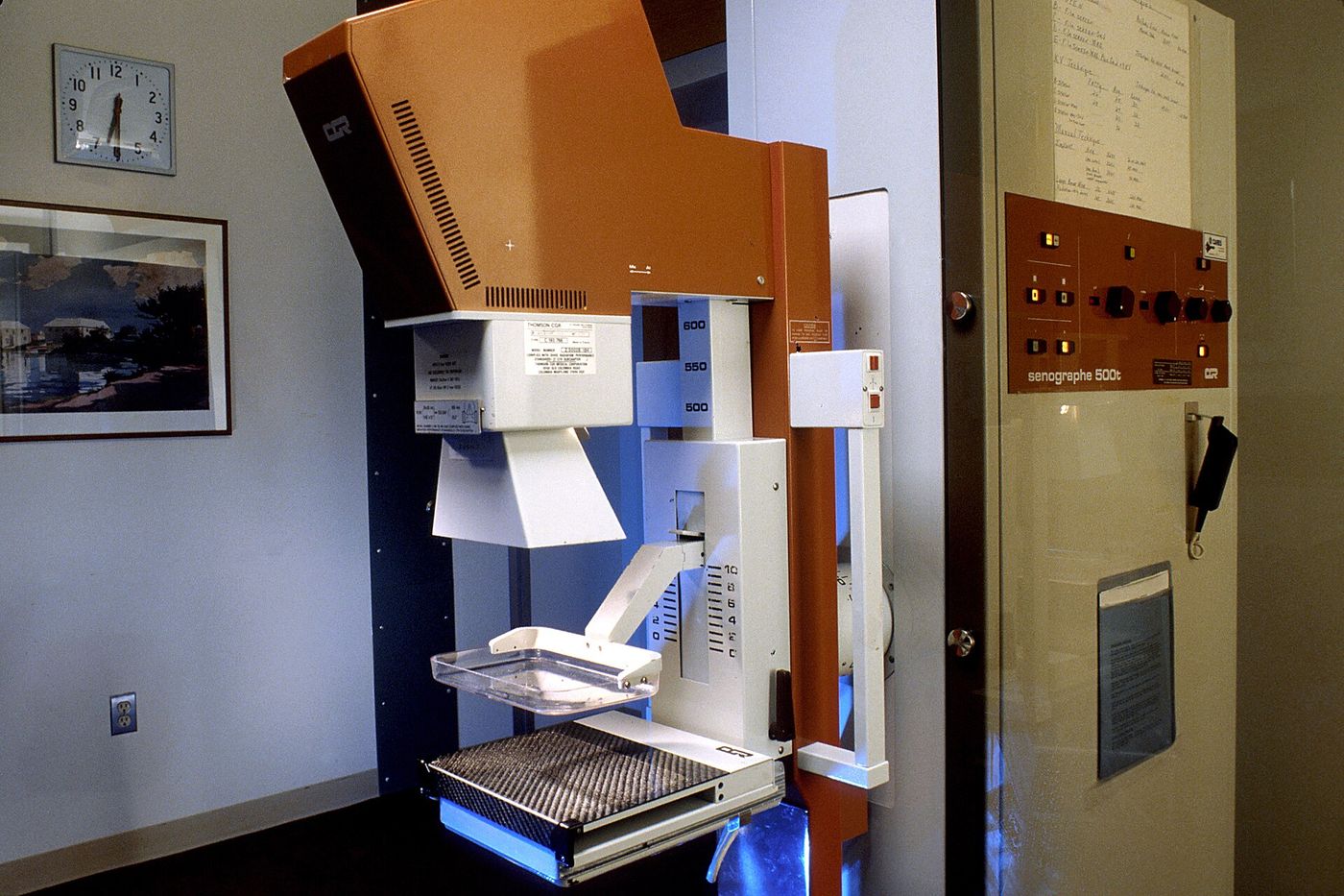 A mammography unit in a hospital radiology department.